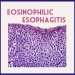 Eosinophilic Esophagitis Causes Symptoms Diangosis And Treatment