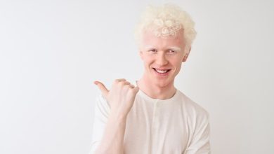 Albinism Symptoms