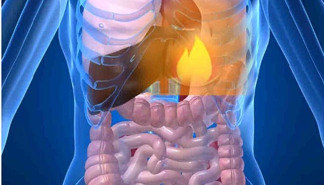 gastroesophageal relux disease