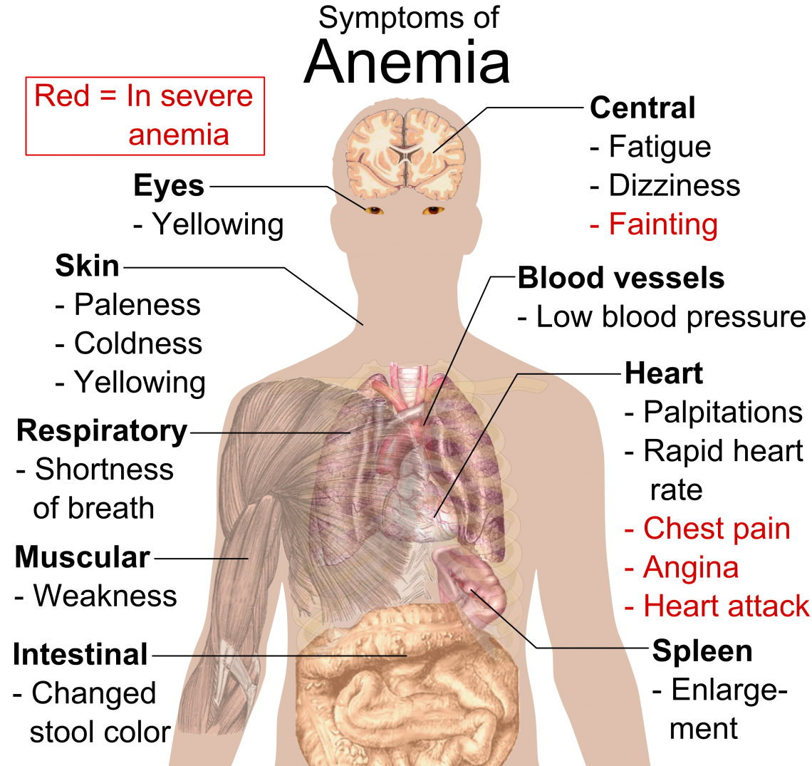 Symptoms Of Anemia 1140x1075 