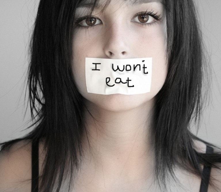 Anorexia Nervosa Symptoms Causes Diagnosis And Treatment Natural Health News