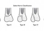 Menkes Disease Symptoms, Causes, Diagnosis And Treatment - Natural ...