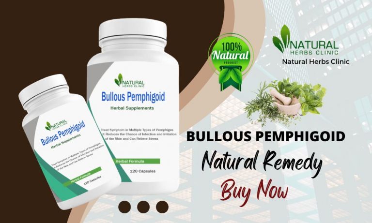 Natural Remedies for Bullous Pemphigoid Archives - Natural Health News