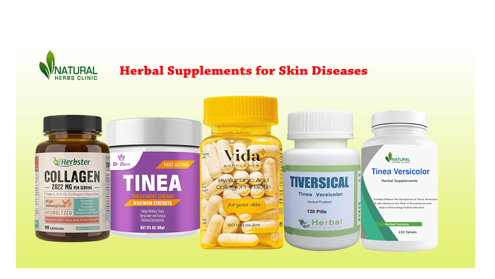 Common Skin Disease and Treatment Using Herbal Supplements