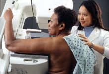 Double mastectomies do not improve breast cancer survival likelihood for most women, study finds