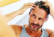 New and natural cure for male baldness is highly effective