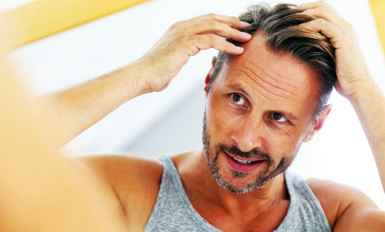 New and natural cure for male baldness is highly effective