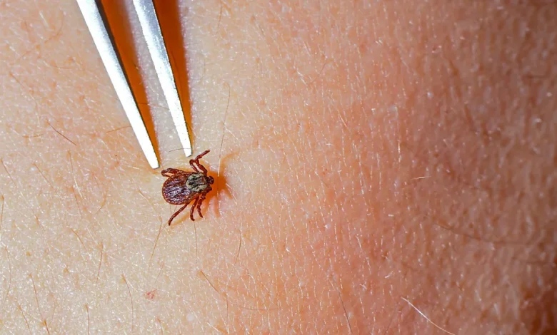 Lyme disease is becoming more common. But its symptoms aren't always easy to spot