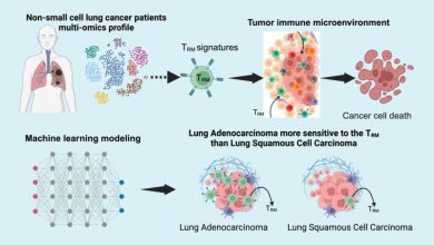 Recent study reveals key immune cells as critical factors in lung cancer prognosis