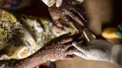 Africa desperately needs mpox vaccines