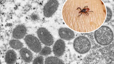 Concerns grow after new tick-borne virus discovered in China