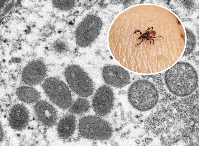 Concerns grow after new tick-borne virus discovered in China