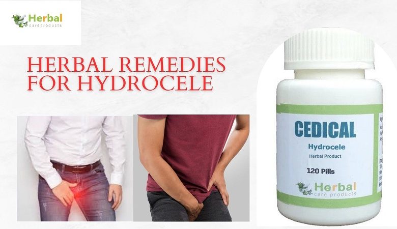 Herbal Remedies for Hydrocele