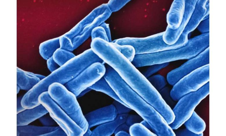 Tribbles protein offers hope for tuberculosis treatment