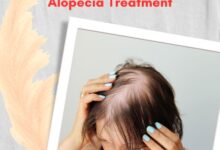 Central Centrifugal Cicatricial Alopecia Treatment (2)