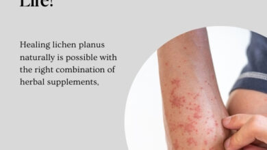 Heal Lichen Planus Naturally