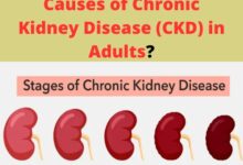 What Are the Primary Causes of Chronic Kidney Disease (CKD) in Adults