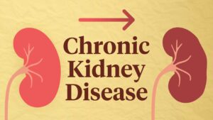 chronic kidney disease