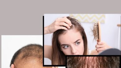 What is the Best Herbal Medicine for Hair Loss