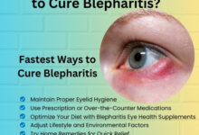 What is the Fastest Way to Cure Blepharitis