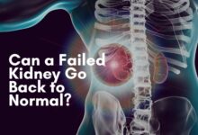 Can a Failed Kidney Go Back to Normal