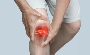 Joint Support Herbal Supplement for Arthritis