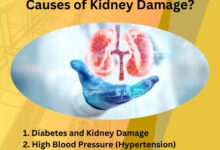 What Are the Four Common Causes of Kidney Damage